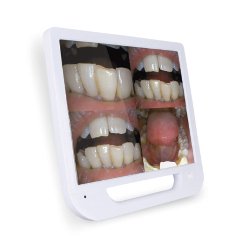 whoesale dental oral camera with custom service-2
