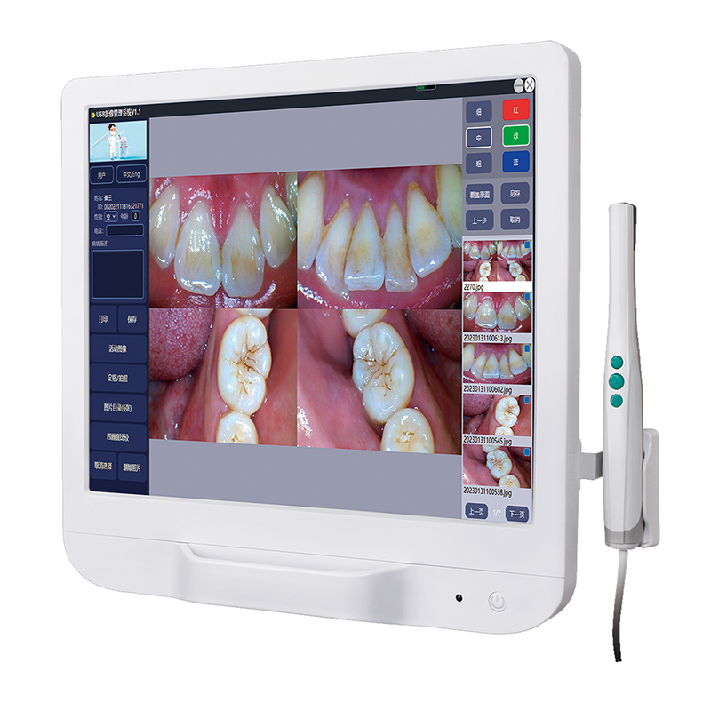 whoesale intraoral camera with screen factory-1