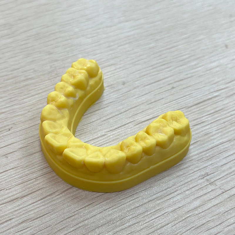 A Full Mouth Dental Implant Model With Dental Crowns And A Dental Bridge