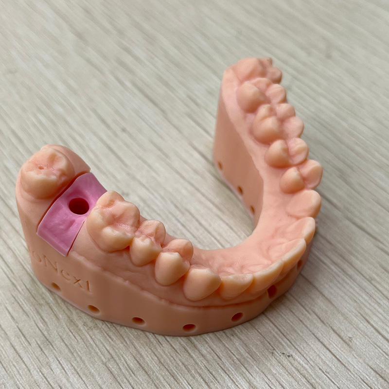 factory direct front teeth crowns supplier-1